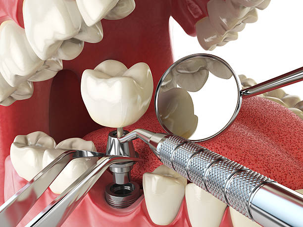 Best Urgent Tooth Repair  in Hawarden, IA